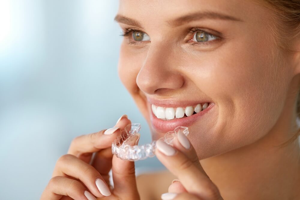 Beim Home Bleaching wird das Bleaching Gel auf die Schiene aufgetragen, bevor diese in den Mund gesteckt wird
