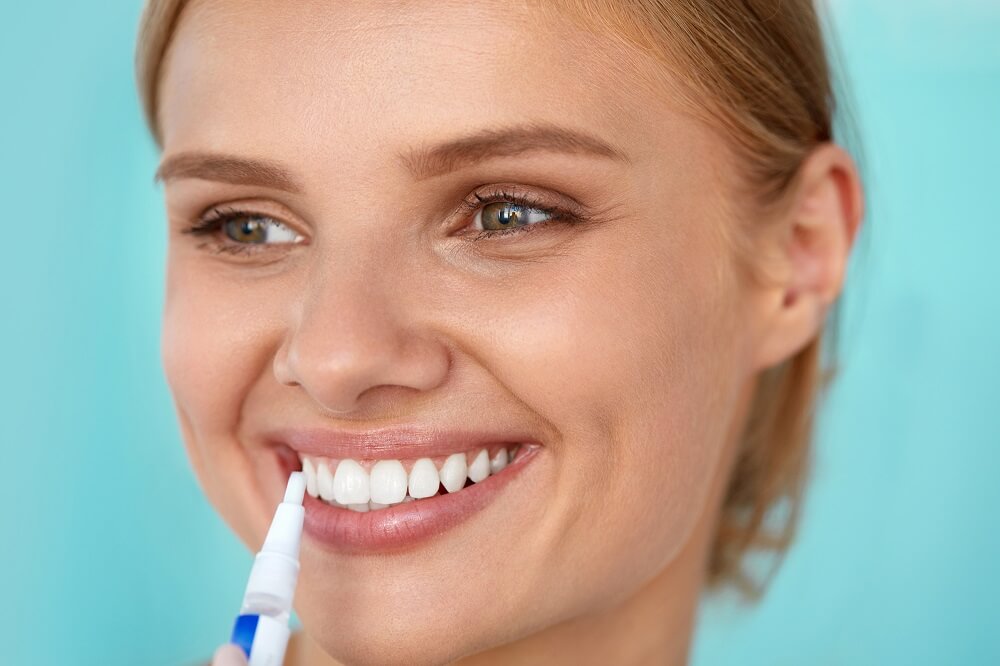 Der Whitening Pen ist eine beliebte und handliche Variante, zu die eigenen Zähne aufzuhellen