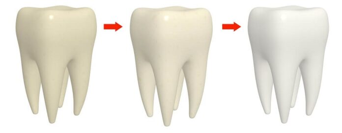Viele Menschen wünschen sich die Aufhellung der eigenen Zähne um ein paar Nuancen - Wir geben Tipps, was gegen gelbe Zähne hilft